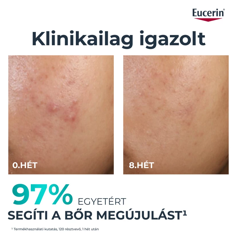 Eucerin DermoPure bőrmegújító szérum 40ml