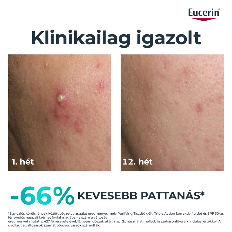 Eucerin Dermopure Clinical Triple Action - Korrektív Fluid 40 ml